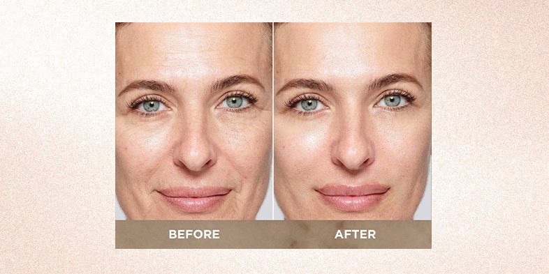 In Article How To Restore Radiance To A Dull Skin Tone Age Perfect Midnight Cream